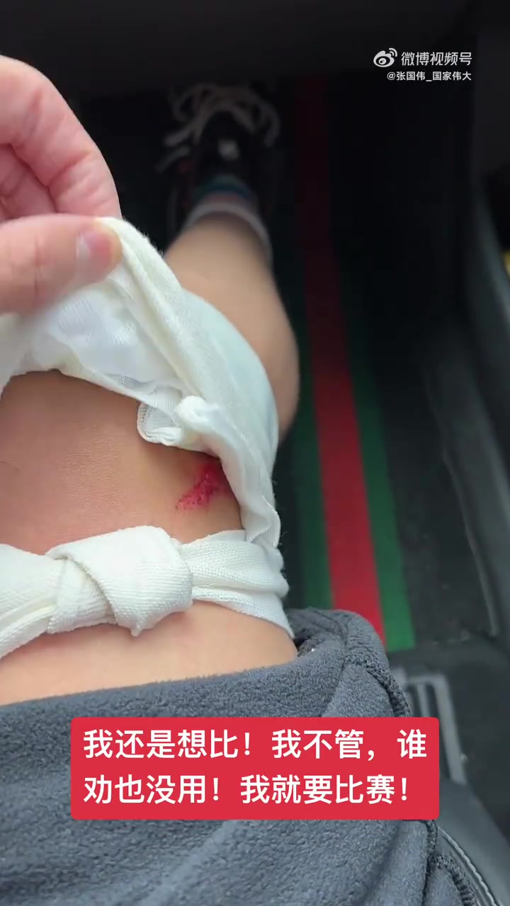 DB视讯百家乐张国伟晒受伤视频：我不管，我就要现在比赛，死也死在比赛场上