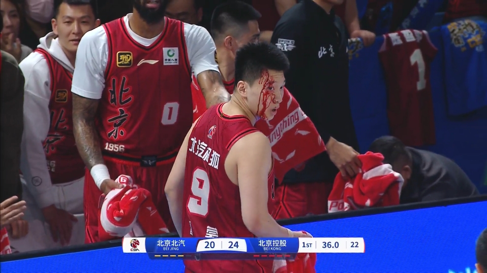 DB电子官网太硬了!雷蒙眼角缝完10针后今天正常训练